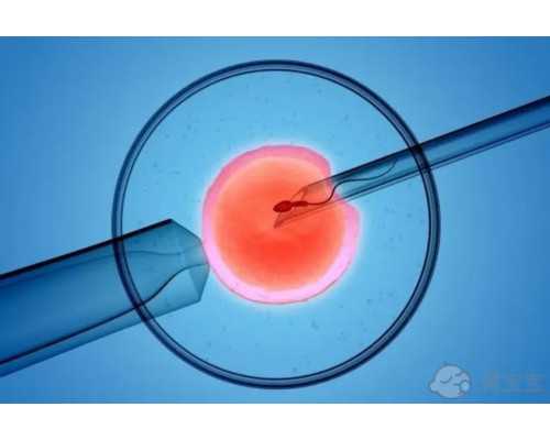 面对子宫内膜癌，卵巢是该保留还是切除？